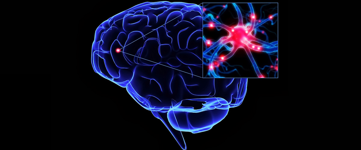 IS YOUR BRAIN ON FIRE: INFLAMMATION AND YOUR MIND